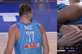 Luka Doncic gets elbowed, leaves game bleeding